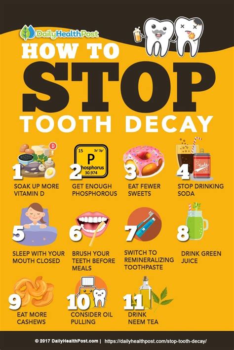Can We Stop Tooth Decay?